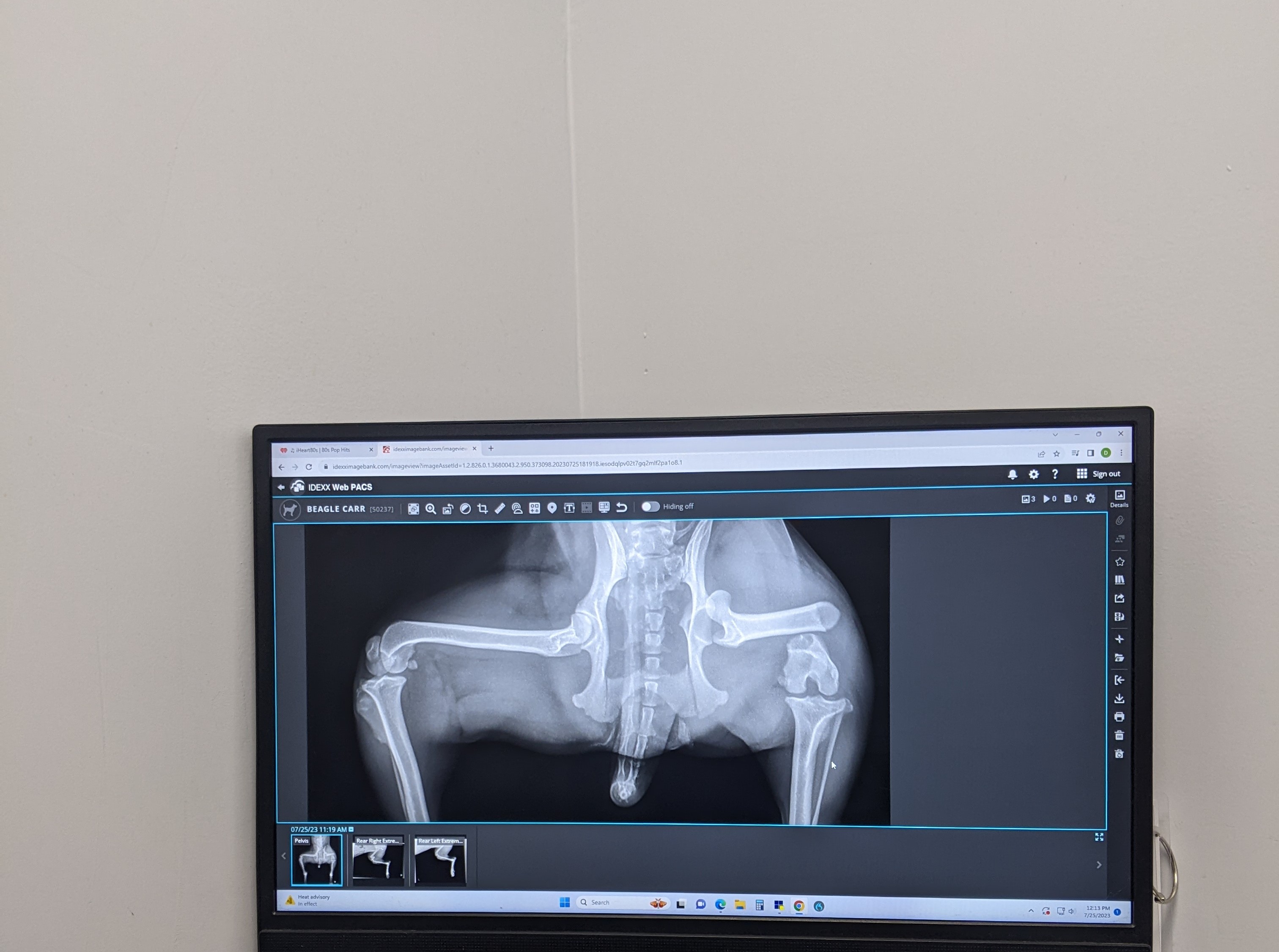 Dog up for Adoption: After Surviving a Car Wreck, Rescuers Heal this Beagle's Leg & Life