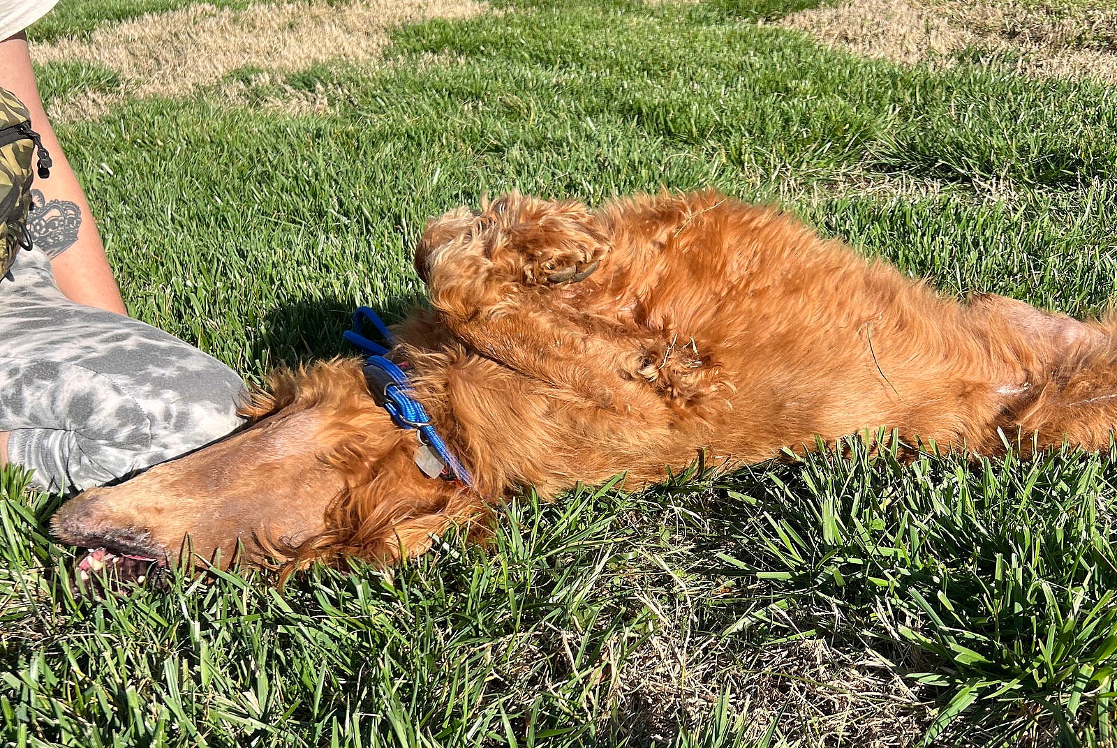 Hershey Nov 23 - A Special Sebaceous Adenitis Boy