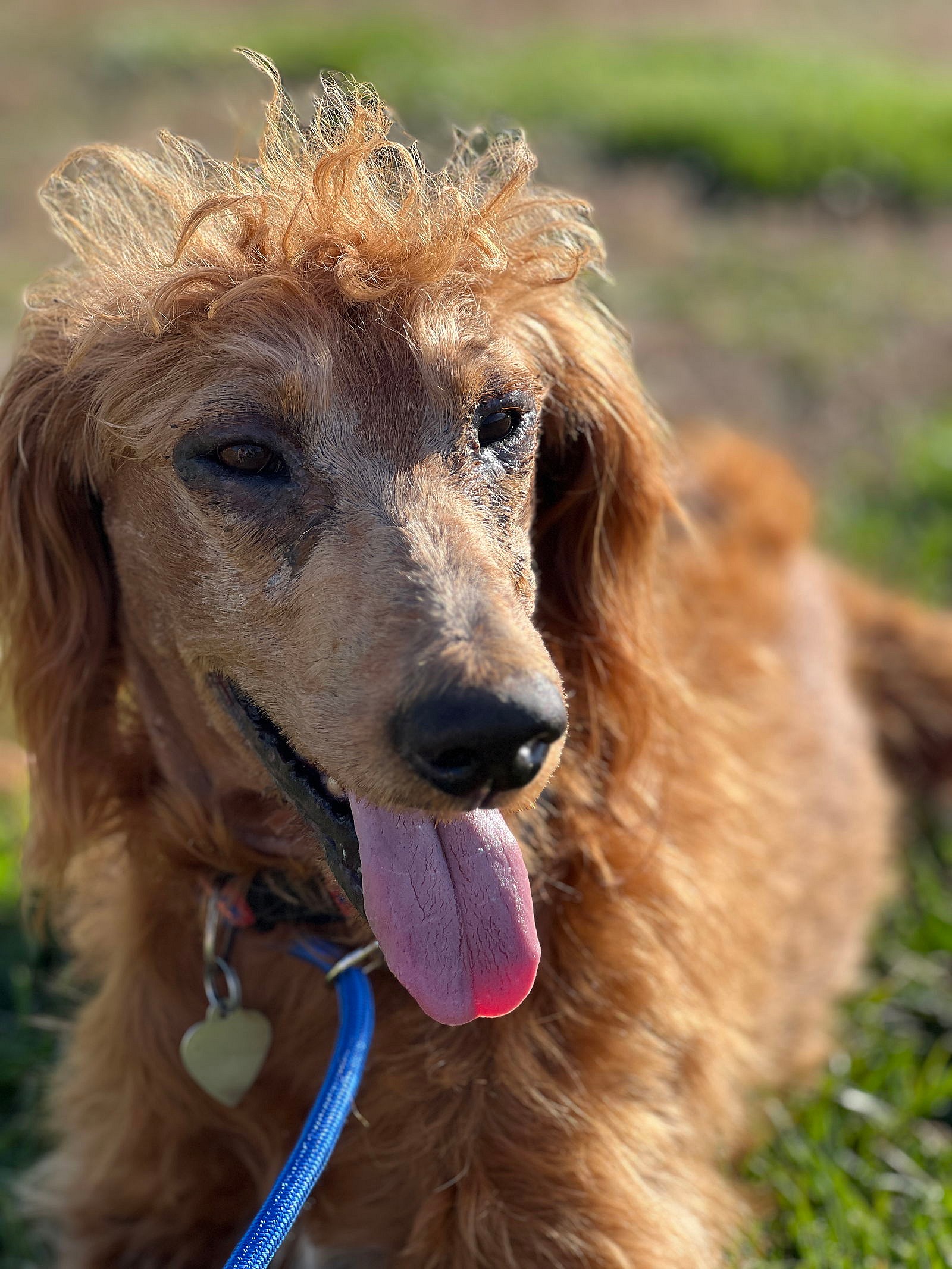 Hershey Nov 23 - A Special Sebaceous Adenitis Boy