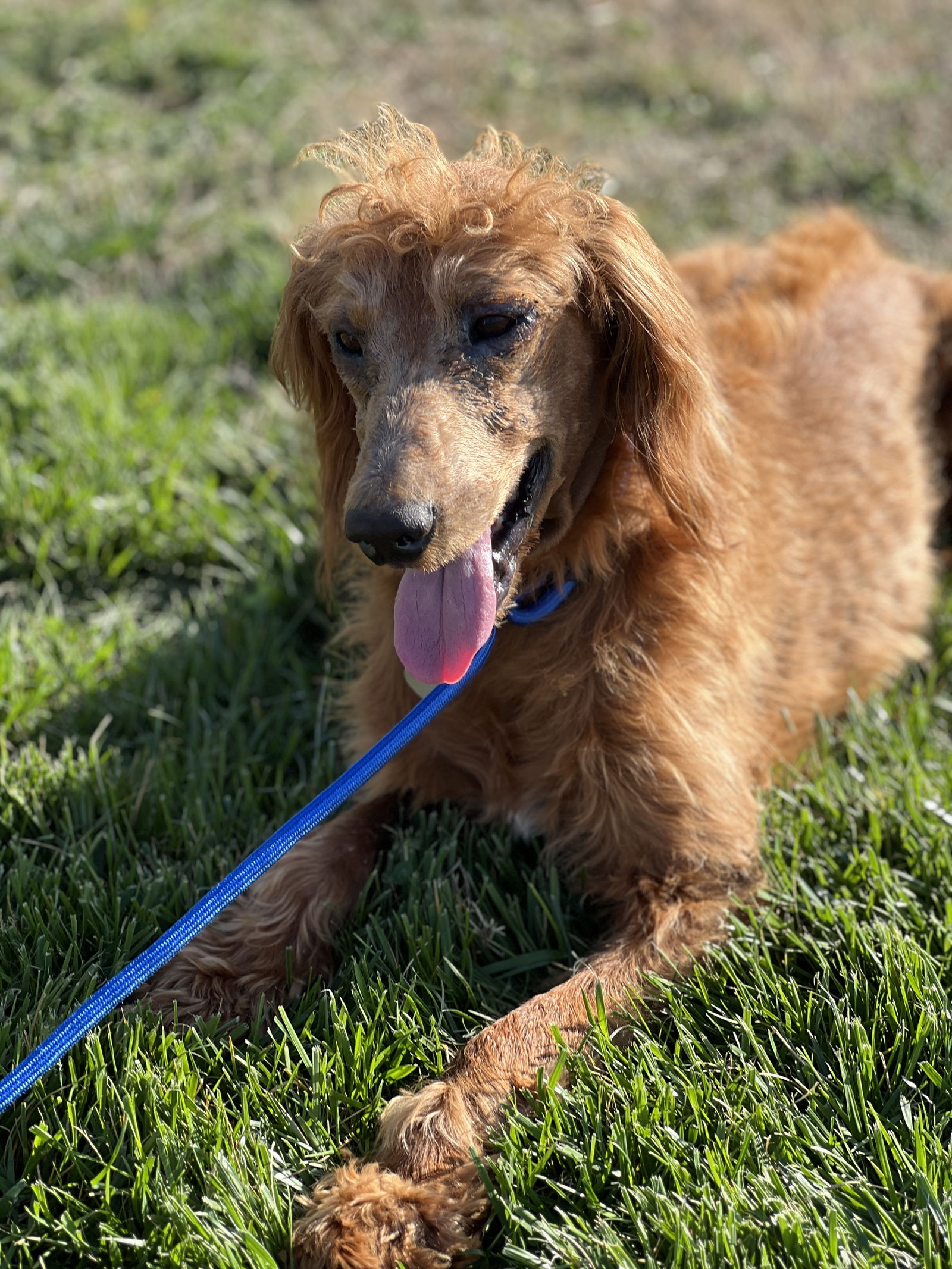 Hershey Nov 23 - A Special Sebaceous Adenitis Boy