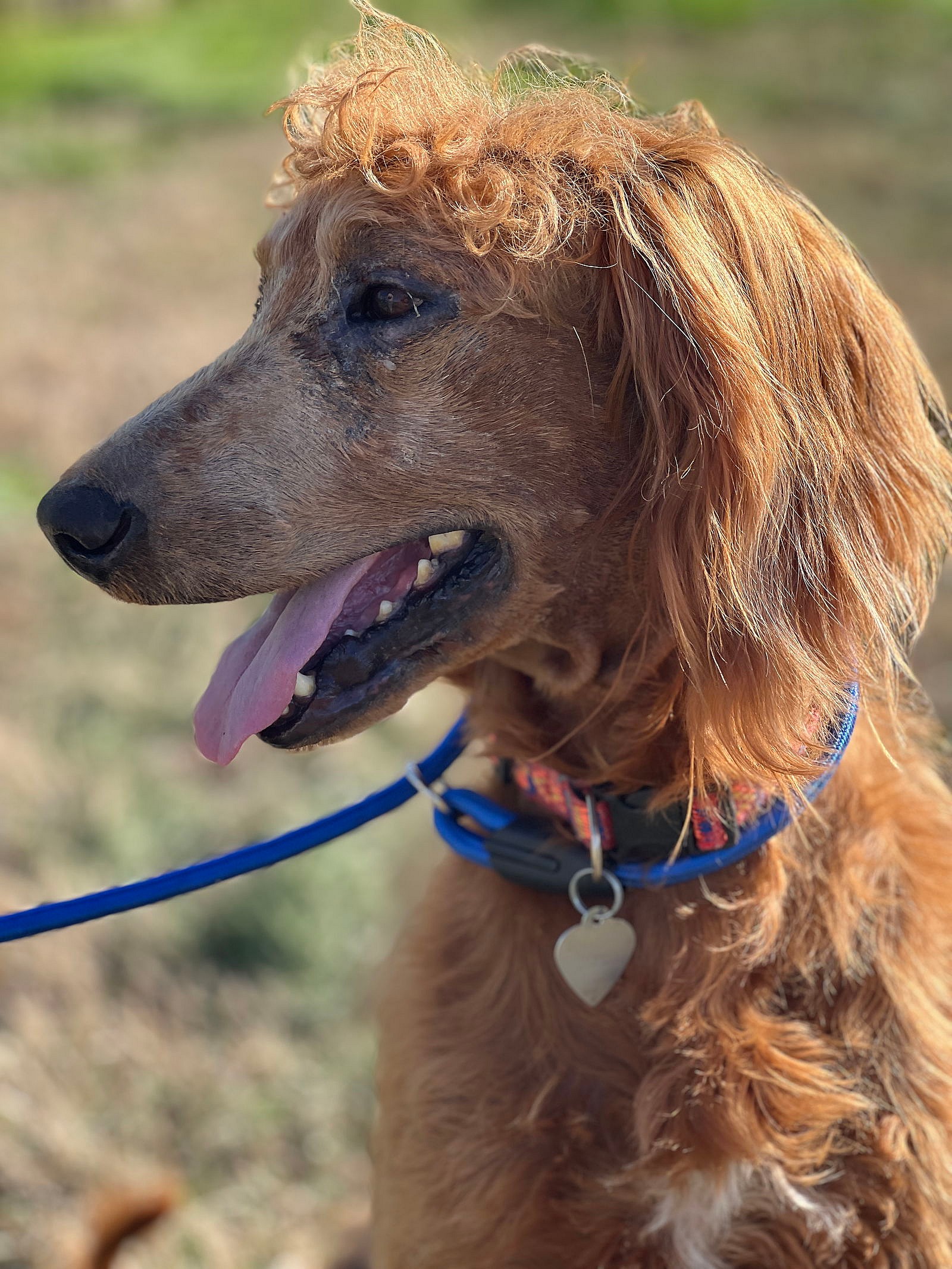 Hershey Nov 23 - A Special Sebaceous Adenitis Boy