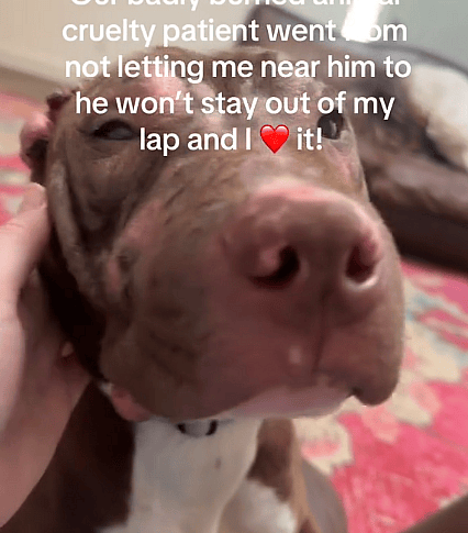 Dog Badly Burned & Set On Fire Makes Remarkable Recovery in Loving Foster Home