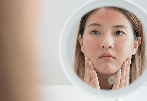 Allergic To Your Dog