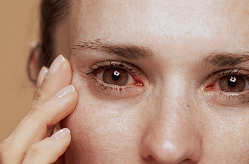 Allergic To Your Dog