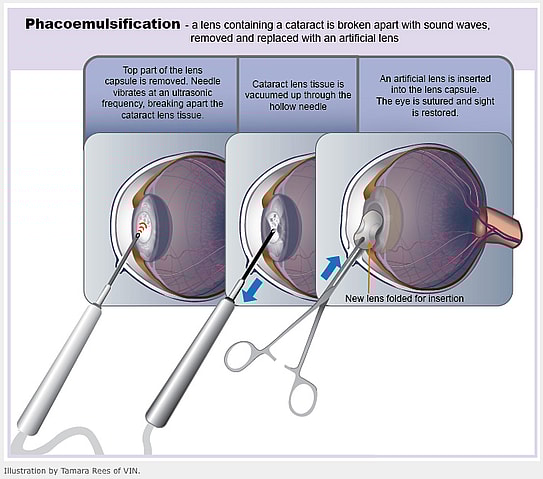 Cataracts Surgery Process in Dogs