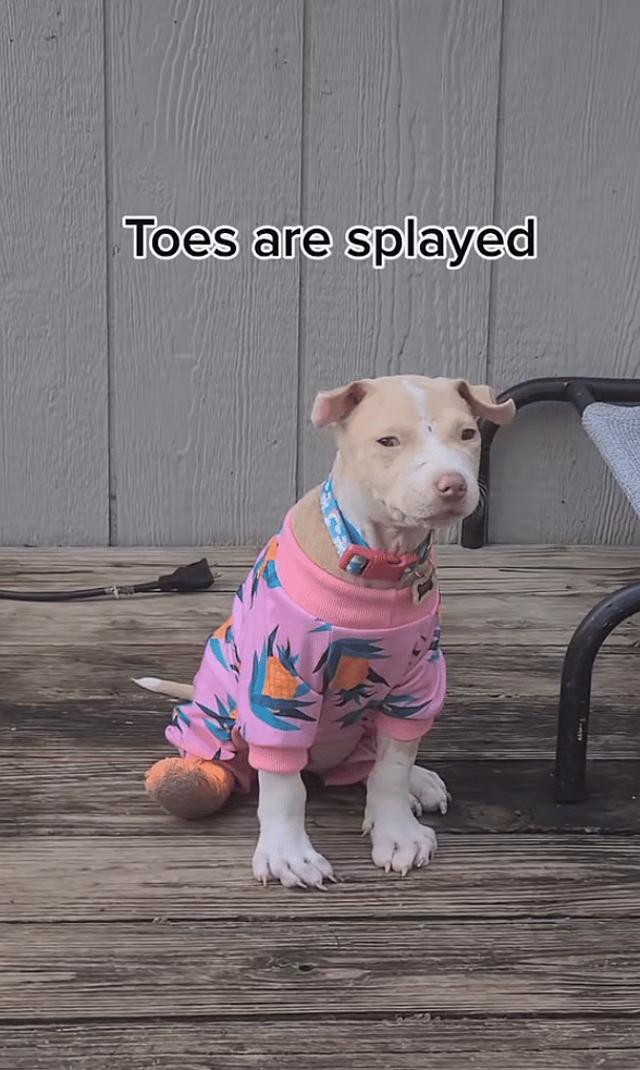 Ehlers-Danlos Syndrome