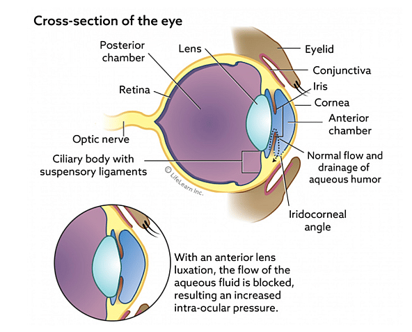 Luxated Lens in Dogs