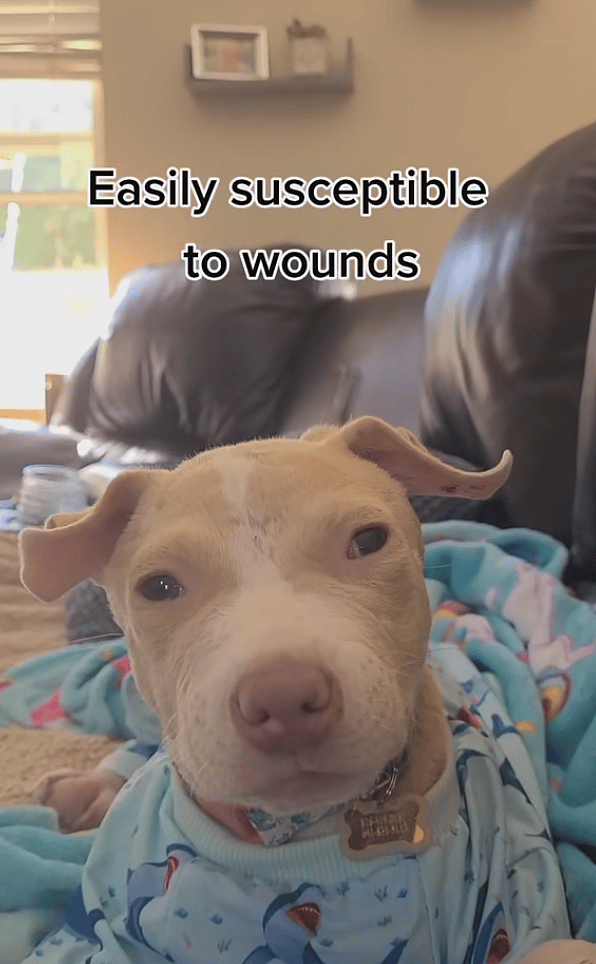 Ehlers-Danlos Syndrome