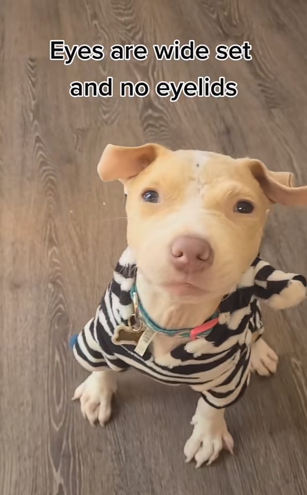 Ehlers-Danlos Syndrome