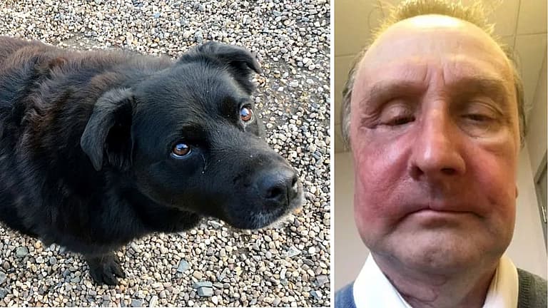 Man Lucky to Be Alive After Dog Sniffed Out Cancerous Tumor in His Face