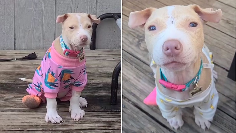 Ehlers-Danlos Syndrome