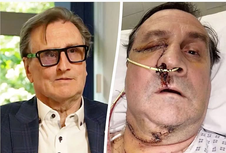 Man Lucky to Be Alive After Dog Sniffed Out Cancerous Tumor in His Face