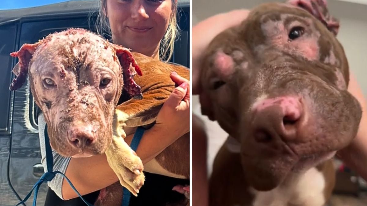 Dog Badly Burned & Set On Fire Makes Remarkable Recovery in Loving Foster Home